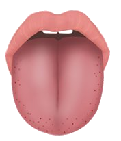 간화형 설진 이미지