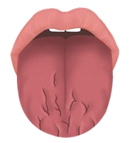 심허형 설진 이미지