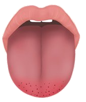 심화형 설진 이미지